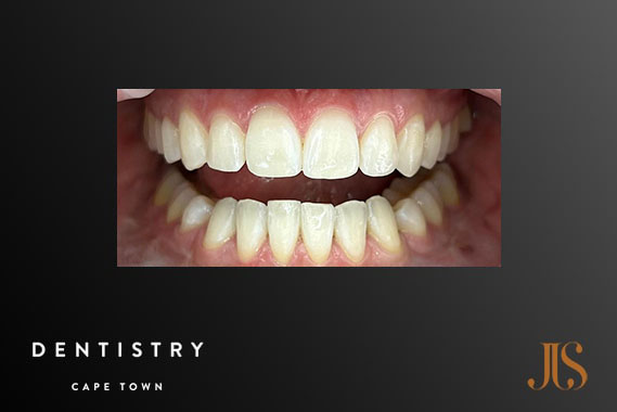 Cosmetic Dentistry Durbanville