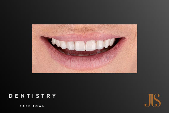 Cosmetic Dentistry Durbanville