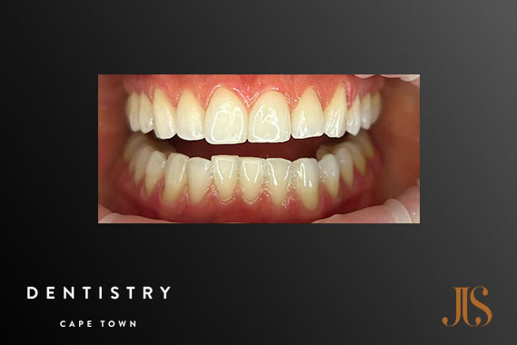 Cosmetic Dentist Durbanville