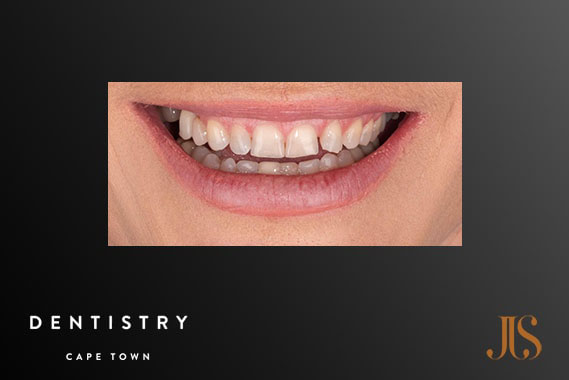 Cosmetic Dentist Durbanville
