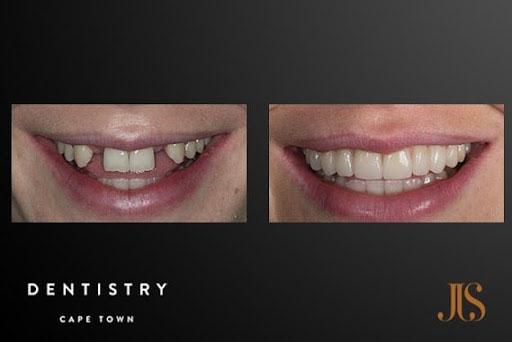 Internation Patients Case 2 | JJS Dentistry