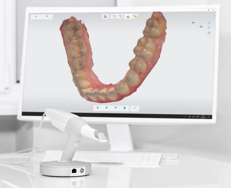 Same-Day Dentistry Step 3