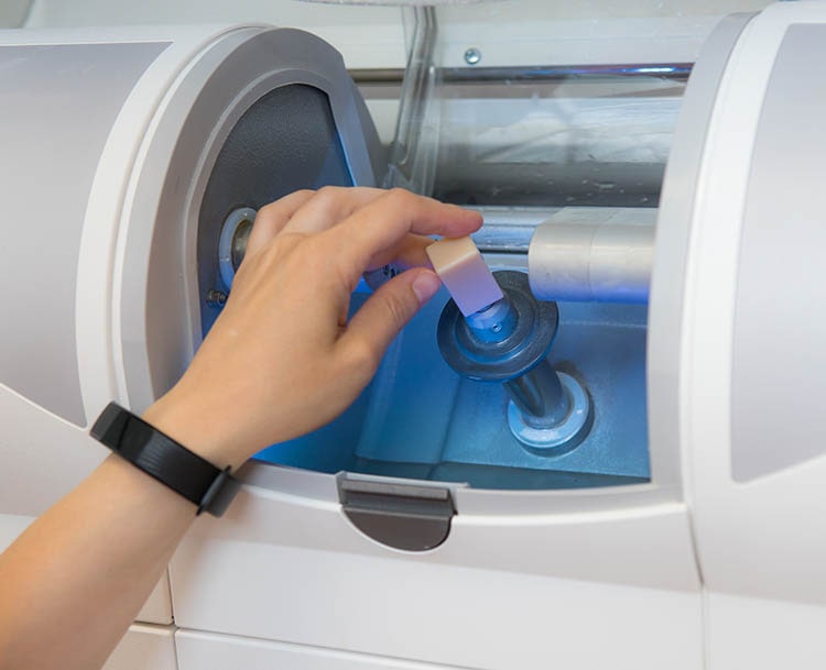 Same-Day Dentistry Step 4